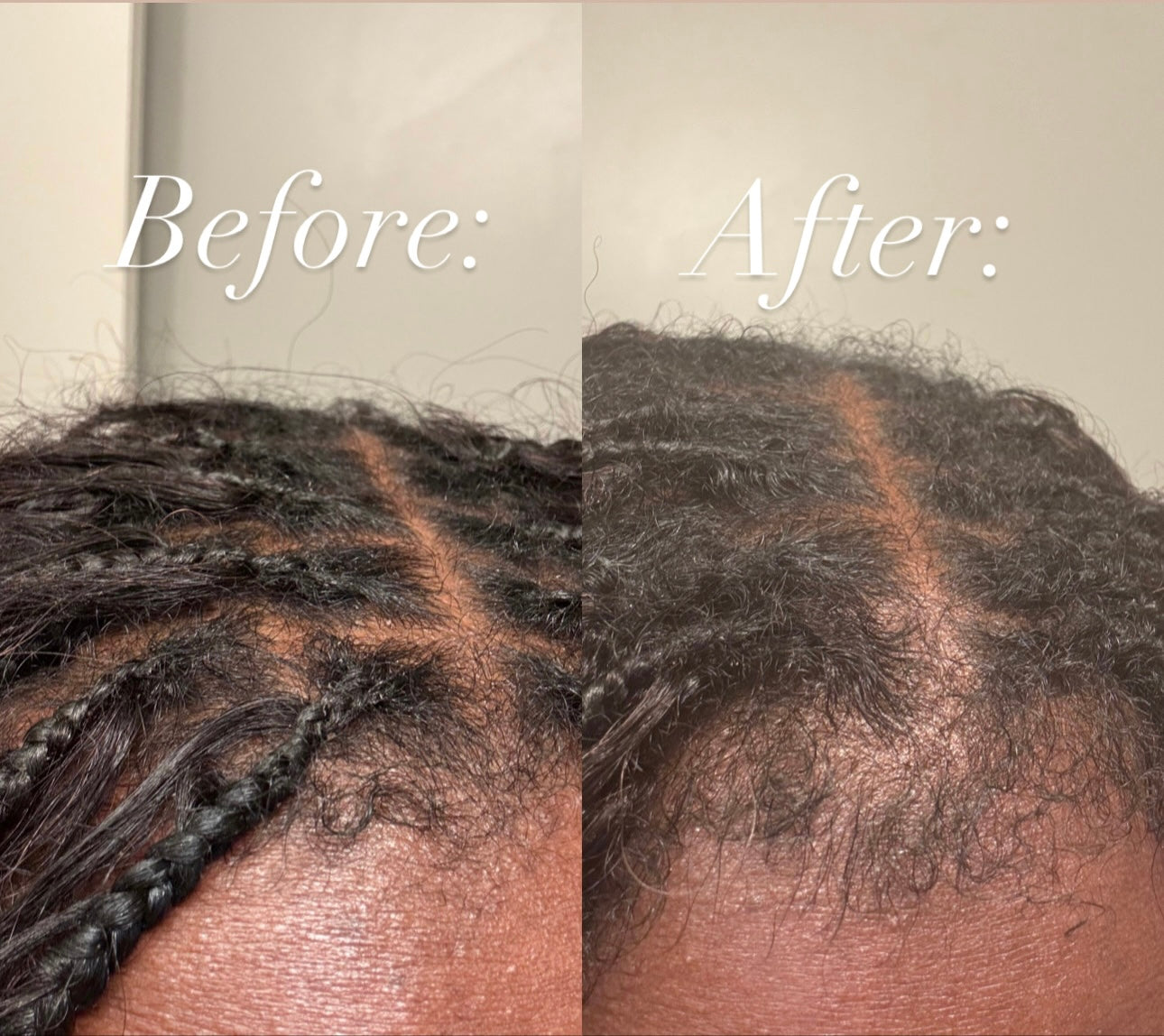 Revitalize Hair Growth Oil